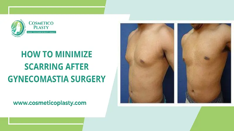 How to minimize scarring after gynecomastia surgery?